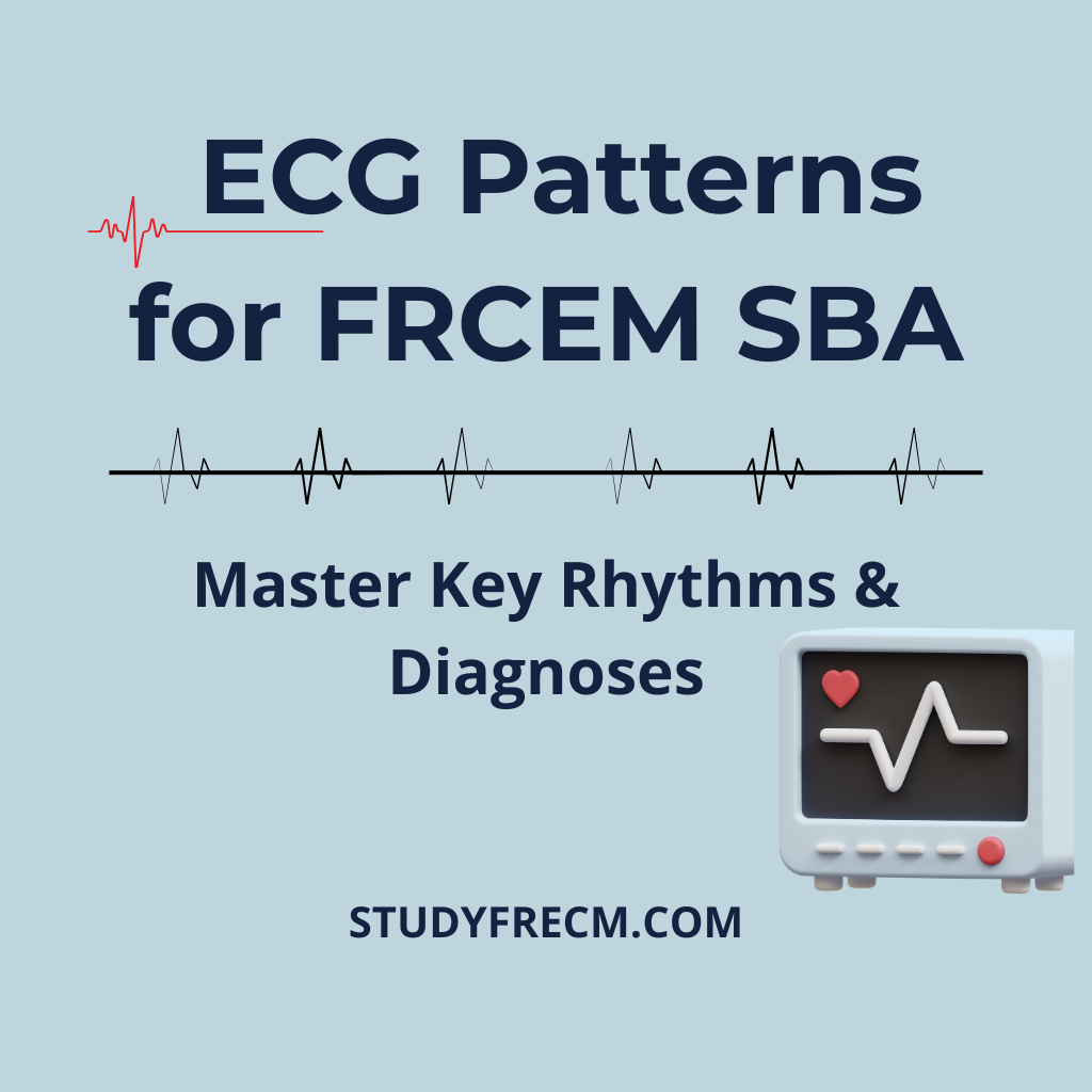 Essential ECG Patterns for FRCEM SBA – Master Key Rhythms & Diagnoses